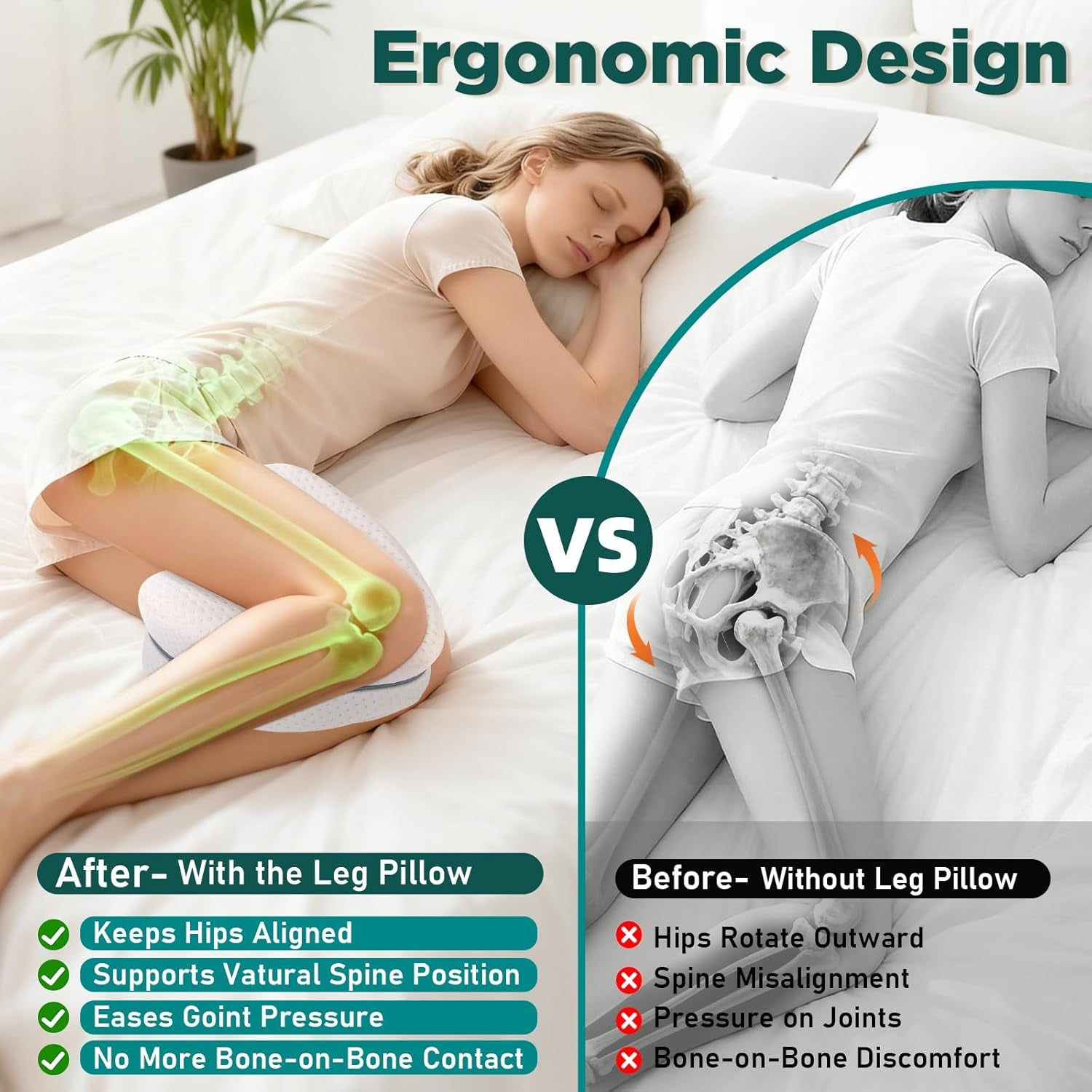 Dioxide Kniekissen Für Seitenschläfer, Beinkissen Ergonomisches Seitenschläferkissen Knie Mit Memory Foam Hüftkissen Für Stützt Beine, Knie, Hüfte, Rücken Und Schwanger Mit Abnehmbarem(Weiß)